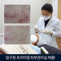 스킨포레 바이시카 60 점빼고 여드름 화농성 좁쌀 뾰루지 병풀추출물효능 딸기코 안면홍조 임산부 군인 레이저 재생 홍조피부 시카크림 얼굴붉은기 피부과 붓기 흉 마스크 점뺀후, 4개 세트