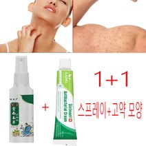 1+1 스프레이 + 고약 모양 습진 주부습진 연고 한약 연고 가려움 을 멈추다 연고, 1 스프레이 +1 고약 모양