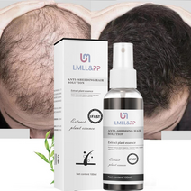 성장촉진 에센스 보습 모발 활력 증진 대머리 초기 발모제, 2개, 100ml