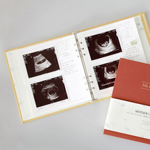 마더스 다이어리 리필 - 초음파앨범 (30P) 태교일기 태아수첩 산모수첩 육아일기 속지 리필용, 구매수량