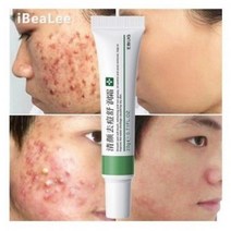 여드름크림 피부트러블 치료제 여드름흉터크림 청소년 성인용 스킨케어제, 20g, 1개