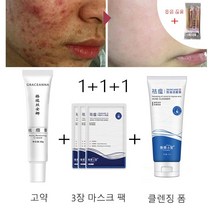 1+1+1 지성피부 얼굴각질제거 피부스케일링 셀프케어 피부환생크림 바늘크림, 여드름크림+여드름클렌저+여드름마스크 3매