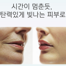 병풀추출물효능 시카 올리브영 재생 점제거후 관리 클리닉 흔적 크림, 시카크림 50g, 1개