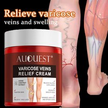 정맥류 치료 크림 다리 피로 혈관염 완화 정맥염 거미 통증 연고 석고 근육 부종 제거, 한개옵션0