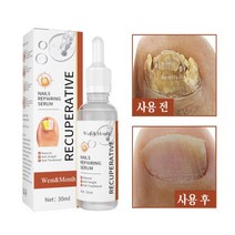 West&Month 발톱무좀치료 네일 트리트먼트 에센스 손발톱 강화리페어, 1개, 30ml