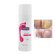 Footlogix 풋로직스 발톱영양제 발케어, 캘러스 소프트너 180ml