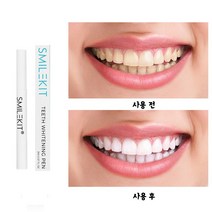 화이트닝 치아미백 스틱 셀프 치아미백겔 신규출신 할인중, 2ml, 1개