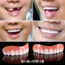 Bayer 독일 치아보호용 마우스피스 임시틀니 한 세트, 임시틀니 한 세트*3