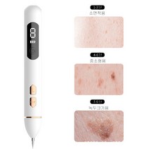 LED 디스플레인 점빼기 얼굴점빼기 셀프점빼기 잡티제거기, 1