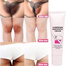 [크림] 미백 크림 개인 부품 팔 허벅지 바디 무릎 피부 마일드 무 자극, [04] 50G, 50G