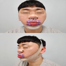 [풀패키지] 업앤드배러 입벌림 코골이 이갈이 방지 밴드 테이프 비강확장기 FULL SET, 리뷰 약속O(FULL SET+ 밴드사은품), 1개