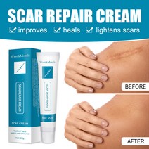 Herbal Scar Removal Cream Gel Stretch Marks Burn Surgical Scars Treatment Smooth Whitening Face Body