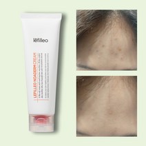 특허완료 항균 여드름 시카크림 무자극 레필레오 노아덤 천연유래 재생크림, 125ml