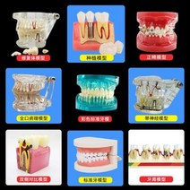 치아 모형 재료상 입모형 칫솔질 모형 치아 치과 충치 교구 치아 모형 구강 교치 모형 틀니, 03 프리미엄 스탠다드 치마모델 C14 화이