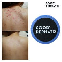 굿더마토 Mint for 데코르테 바디바 115g (등드름바디바 천연수제비누 닭살좁쌀튼살엉드름가드름), 1개