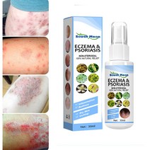 South Moon 1+1 피부 건선 미스트 피부 붉은반점 피부 가려움증, 30ml