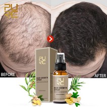 PURC 빠른 성장 헤어 에센스 스프레이 짙은 오일 트리트먼트 탈모 영양 소프트 리페어 데미지 세럼 케어, 한개옵션0