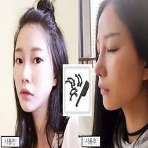 다파요 2세트+1세트 셀프 코성형 콧볼 축소 코뽕 코끝 높이기, 3SET, 코뽕 3쌍
