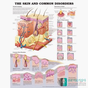 인체해부도 3D차트 병원액자 9940B 피부질환 피부구조 54X74cm _액자없음, BS346_액자없음, 1개