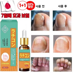 손발톱 리페어 발톱연화 영양제, 2개, 30ml