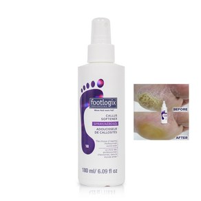 Footlogix 풋로직스 캘러스 소프트너 180ml 발뒤꿈치갈라짐 발바닥케어, 1개, 1개입