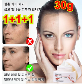 1+1+1 검은 반점 제거 크림 브라이트닝 반점 제거 완화 크림 화이트닝 반점 제거 크림 30g, 30g*1+1+1개, 3개