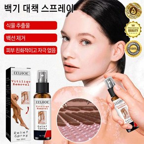 1/1+1 백반증 수리 스프레이 백선 대책 스프레이 화이트 스팟케어 백반수리 피부보호, 30ml*1, 2개