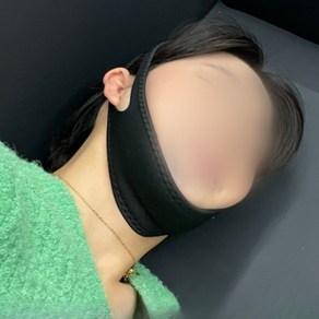 잇몸훼손방지밴드 코골이방지밴드 잇몸보호밴드 잠김방지밴드 수면방해방지밴드 밴드 블랙 코골이 입벌림방지 입벌림방지밴드, 1개