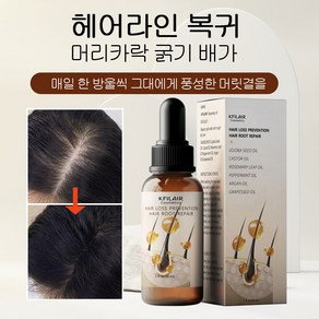 KFILAIR osemay oil 로즈마리 에센스 모발 성장 촉진 탈모예방 치료 로즈마리 오일 토탈 모발케어, 1개, 30ml