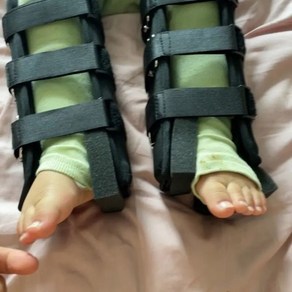 오다리교정기 무릎 휜다리 골반 팔자걸음 에어백 성인 체형 구부러진 X다리, 검정 XXS 키 60-70센티 적당, 1개