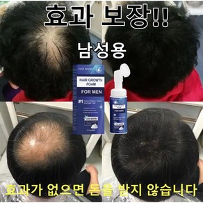 탈모 예방 두피케어 탈모남성을 위한 디자인, 3개, 60ml