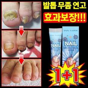 [빠른 배송] 내성 발톱 연고 무좀약 손톱 발톱 치료제 문제성 손발톱 영양제 풋 솔루션 케어 앰플, 6개, 20g