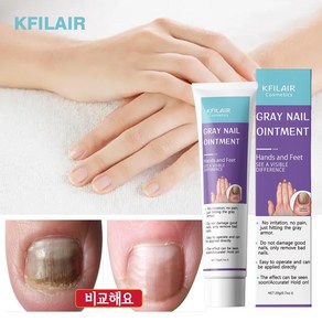 KFILAIR 발톱 리페어 연고 손톱 케어 손톱과 발톱 강화, 3개, 20g