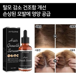 [당일 배송] 원형 탈모증 KS인증 치료제 M자형 예방모낭 성장 개선 LY006, 2개, 29ml