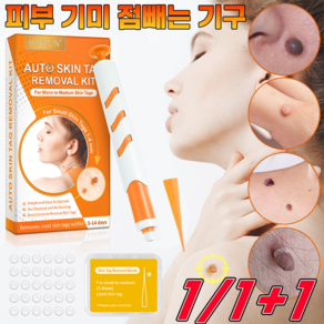 [효과 보장] 스킨 태그 제거 키트 태그 제거기 피부 얼굴 기미 제거 도구 점빼기 펜 피부 케어 세트, 1개