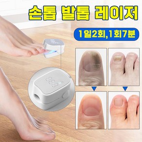 [미국 기술] 손톱 발톱 레이저 문제성 네일 치료기 곰팡이 제거 풋케어, 2개, 화이트