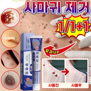 [국내배송] 1+1/2+2 미국 피부 치료 편평 연고 신속하고 효과적인 기미 비립종 제거 스킨 제거 크림 최저가격 포장증정, 2개, 20g