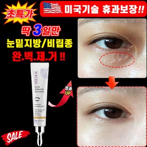 [당일발송] 미국기술 2+2/1+1/1 아이크림 아이팔트 아이백 크림 비림종 눈밑 지방제거 눈가 주름 개선 눈밑꺼짐 다크서클 제거 얼굴 리프팅 포장증정, 1개, 16g