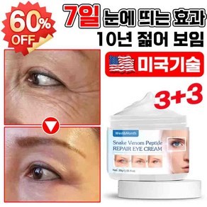 독일기술 1+1 루테인 5분 아이백크림 50대이상 눈밑 지방 꺼짐 미간 눈가 이마 팔자 주름 개선 다크서클 제거 리프팅 단백질 콜라겐 링클 아이크림, 6개, 30g