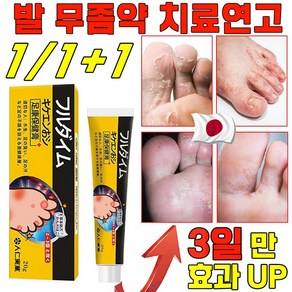 [국내배송] 일본 발톱 무좀약 치료 연고 발바닥 발가락 가려움증 연고 발냄새 제거 크림 문제성발 치료제 효과보장, 20ml, 1개, 1개입