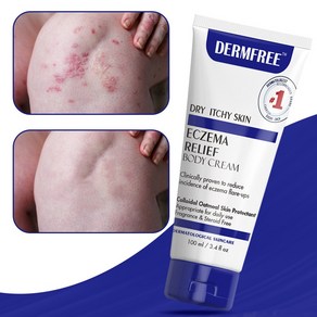 DERMFREE 두드러기 피부 가려움 피부염 크림 피부 발진 연고