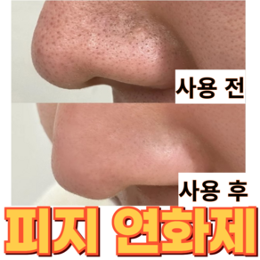 피부과용 피지 연화제 피지녹이는제품 블랙헤드 제거 모공팩 코피지제거 모낭충제거 멜팅클리어 제이블릭 특허, 90g, 1개, 1개입