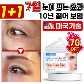 독일기술 1+1 루테인 5분 아이백크림 50대이상 눈밑 지방 꺼짐 미간 눈가 이마 팔자 주름 개선 다크서클 제거 리프팅 단백질 콜라겐 링클 아이크림, 2개, 30g