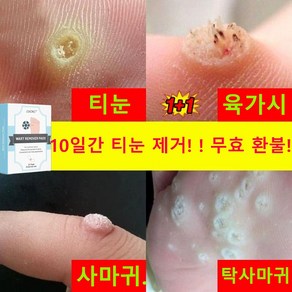 [국내배송]보호테이프 발바닥 통증 풋케어, 2개