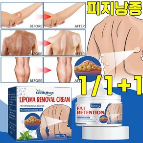 [미국 기술] 피지낭종 연고 피부 표피낭종 제거 연고 지방종 완화 크림 피부과 전용