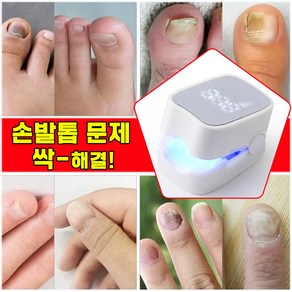 [당일 발출] 발톱 레이저 치료기 손톱 문제성발톱 관리기 네일레이저, 1개