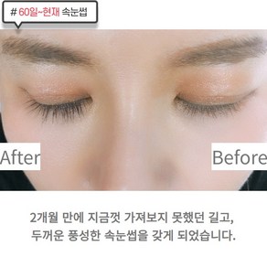 기린아이래쉬 속눈썹영양제 GILYN EYELASH SERUM