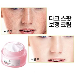 멜라토닝크림 검버섯크림 기미검버섯 주근깨 제거피부 미백 개선, 3개, 50g