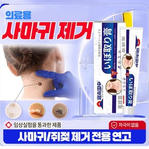 (일본수입)피부연고 순수 천연식물 추출물 빠르고 효과적인 치료*편평사마귀*사상사마귀*안면사마귀*hpN바이러스oy004