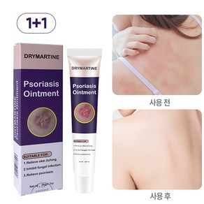 DRYMATYINE 건선 크림 습진크림 발진 가려움 두피건선 가려움완화, 20ml, 2개